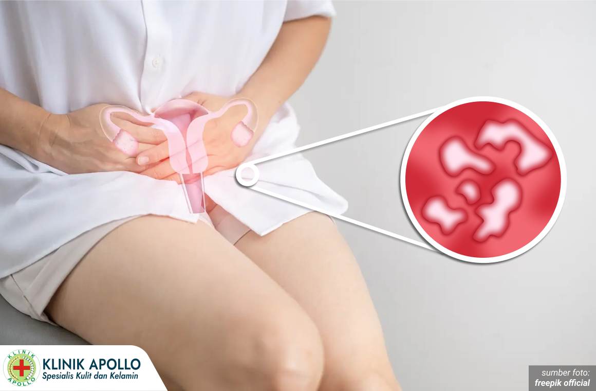 mengobati luka di vagina 1_1_11zon