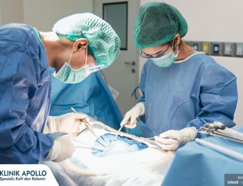 Operasi Bartholin untuk Mengatasi Kista dan Abses, Ini Tahapannya!