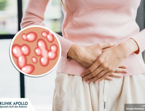 6 Ciri Awal Infeksi HPV pada Wanita, Jangan Abaikan Bisa Picu Komplikasi!