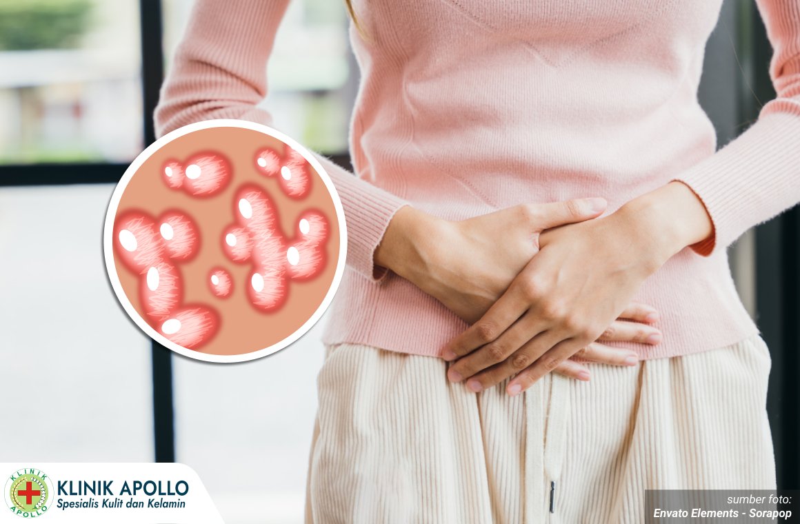 ciri hpv pada wanita 1_2_11zon