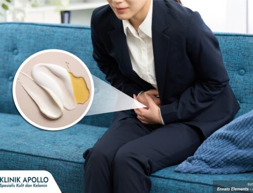 Keputihan Berubah Warna, Apakah Berbahaya Bagi Wanita? Ini Penjelasannya!