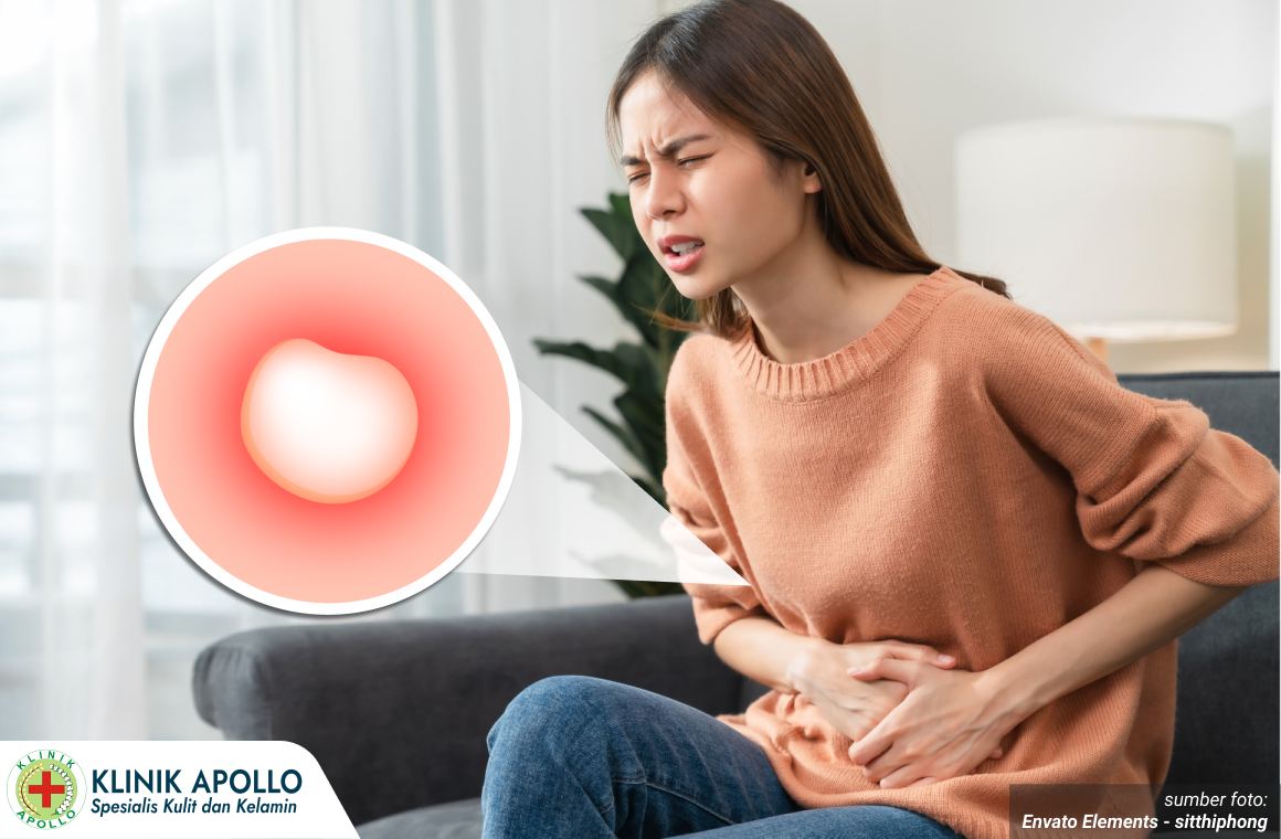 kista bartholin bernanah 1_2_11zon