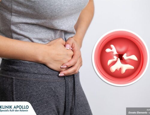 Luka Bernanah di Kelamin? Waspada Tanda Infeksi Serius yang Perlu Diwaspadai