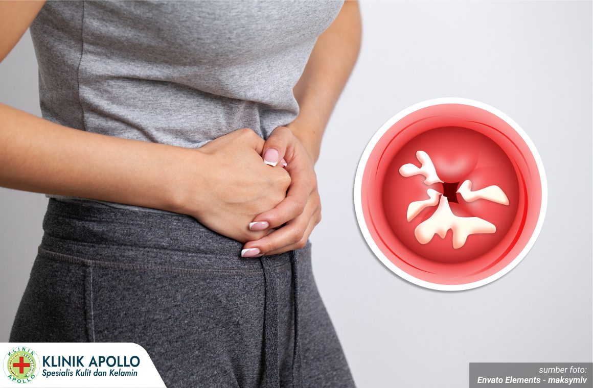 luka bernanah di kelamin 1_4_11zon