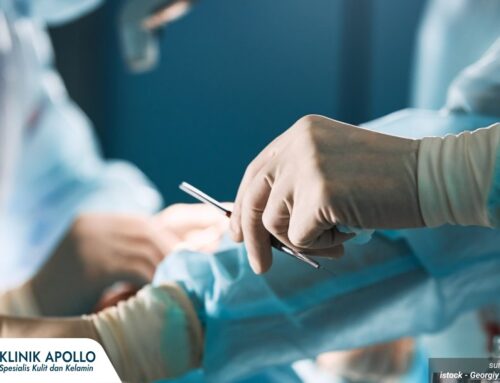 Metode Laser Sunat Dewasa yang Banyak Dipilih, Apa Alasannya? Cek di Sini!