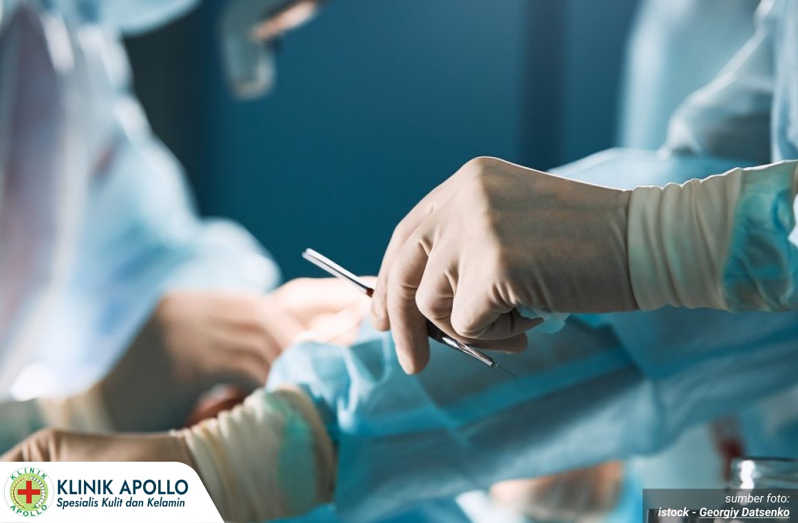 metode sunat dewasa 1_3_11zon