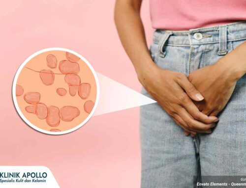 Bahaya dan Dampak Mengabaikan Gejala HPV pada Wanita, Waspada!