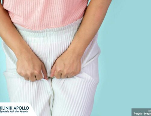 Tak Sekedar Keputihan! Ini Dia Tanda-Tanda Infeksi di Alat Kelamin Wanita