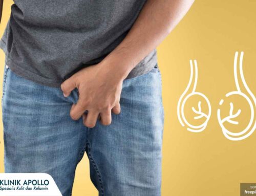 Banyak Pria Mengalami Testis Besar Sebelah dan Terasa Berat, Apa Penyebabnya? Cek Yuk!