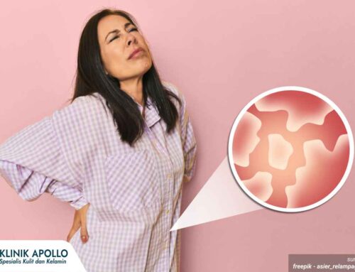 Keluar Nanah dari Kewanitaan Semakin Banyak? Ini Faktor yang Bisa Menjadi Penyebabnya!