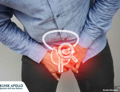 Pengobatan Penyakit Prostat Sesuai Jenis dan Penyebabnya
