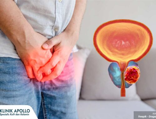 Jenis-Jenis Penyakit Prostat yang Sering Terjadi pada Pria