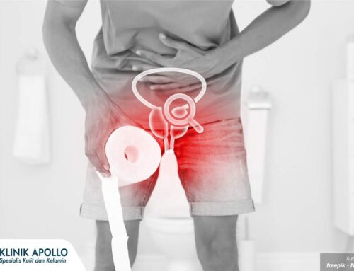 Penyakit Prostat: Gejala, Penyebab, dan Cara Mengatasi