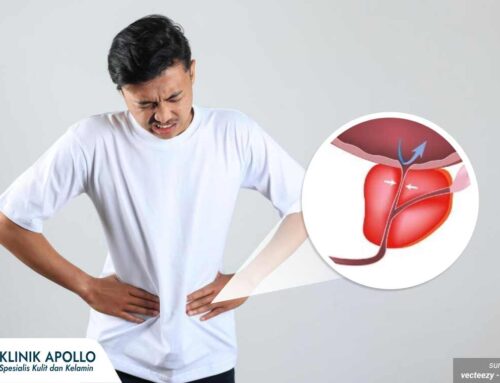 7 Komplikasi Prostat yang Perlu Diwaspadai Sejak Dini