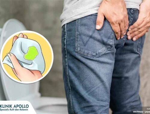 Penis Keluar Nanah: Penyebab, Gejala, dan Cara Mengatasinya