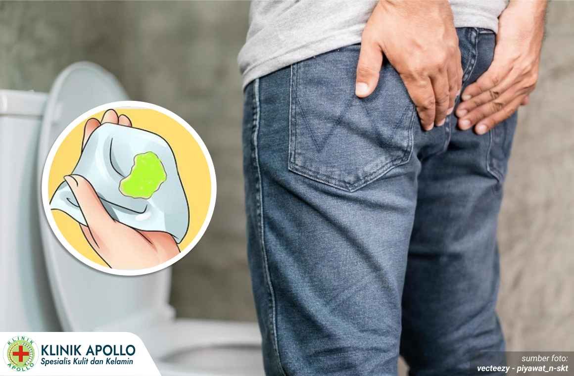Penis Keluar Nanah 1_5_11zon
