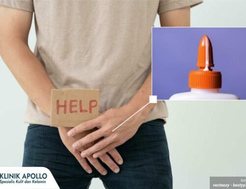 Cara Mengobati Penis Keluar Nanah, Jangan Sembarangan Minum Obat!