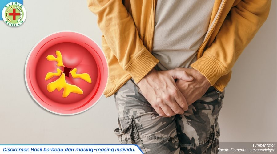 penis keluar cairan kuning 2_4_11zon