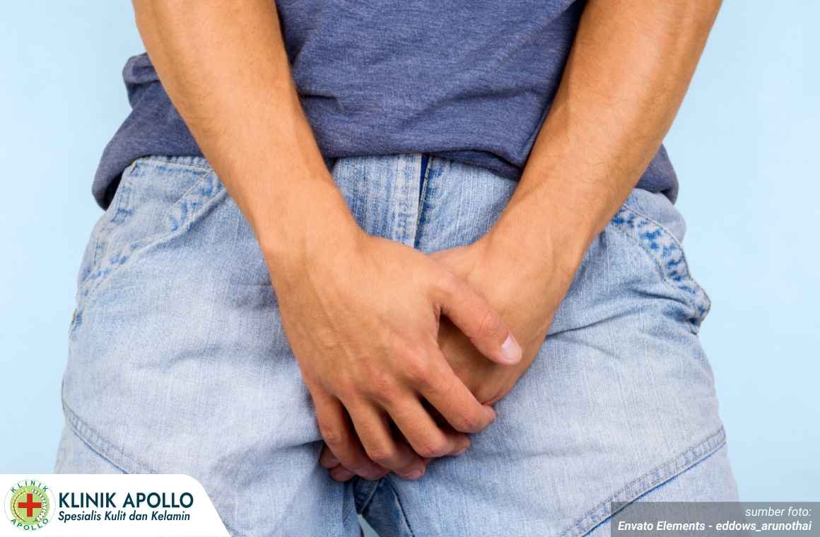 penis keluar nanah tanpa nyeri 1_1_11zon