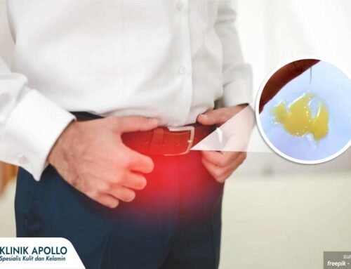Penyebab Penis Keluar Nanah: Gonore atau Penyakit Lain?