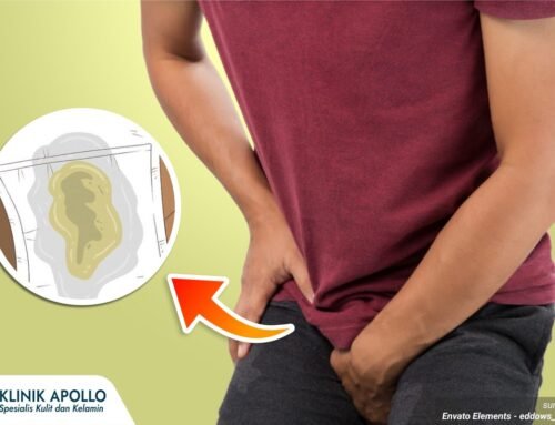 Keluar Nanah Tapi Kencing Tidak Sakit, Apakah Bahaya?
