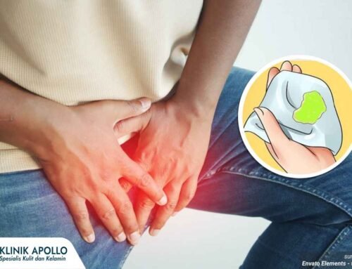 Keluar Nanah tapi Tidak Sakit? Ini 5 Penyebabnya