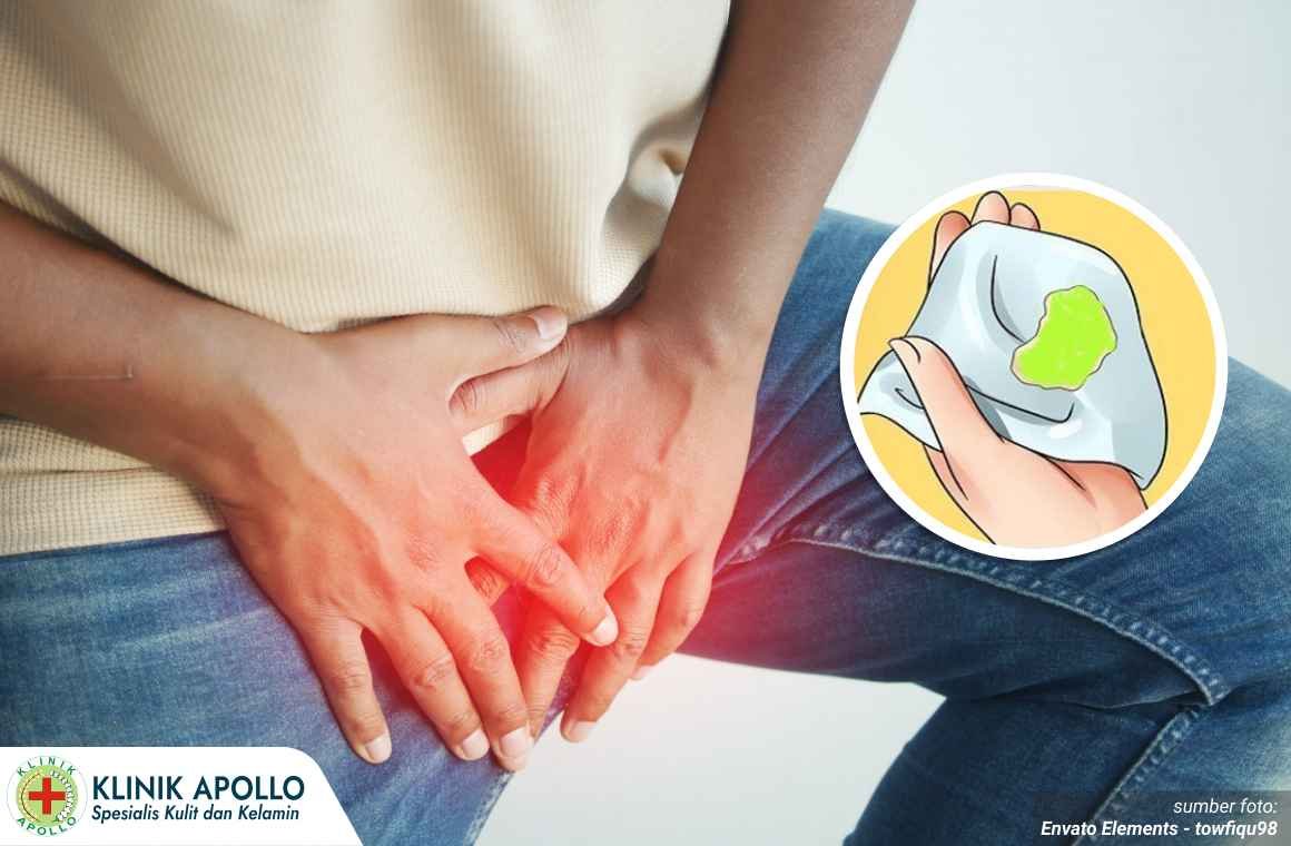 Keluar nanah tapi tidak sakit 1