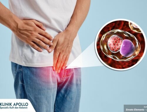 Klamidia pada Pria: Kenali Gejala dan Cara Mengobatinya