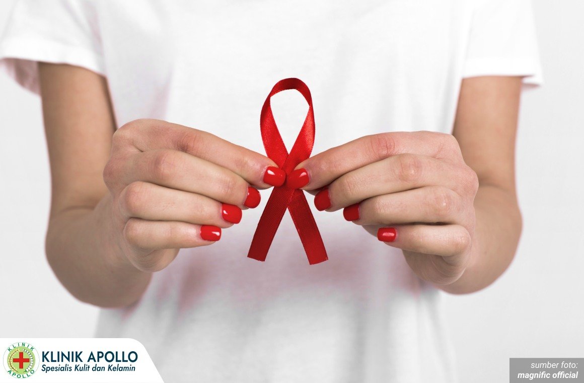 apakah kencing nanah termasuk hiv 1