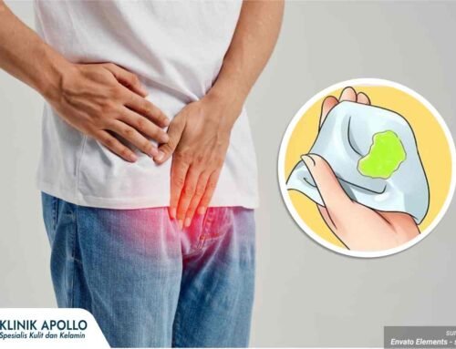 Penis Keluar Lendir: Penyebab dan Kapan Harus Waspada
