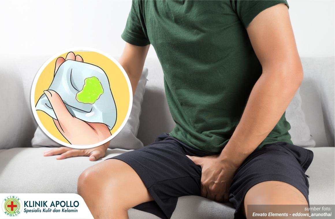 penis keluar nanah dan sakit 1